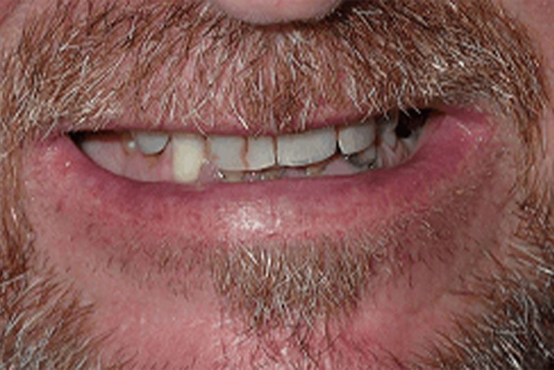 Before